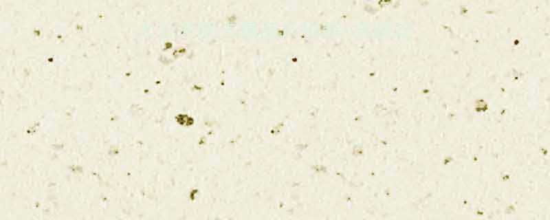 10种冰糖葫芦热量大公开低卡糖葫芦推荐自制攻略吃货也能健康吃-第1张图片-ZBLOG